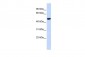 IDH2 antibody - middle region
